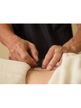 鍼灸施術を受けたい