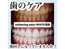ホワイトニングサロン ホワイト(WHITE)/セルフホワイトニング/大阪/福島