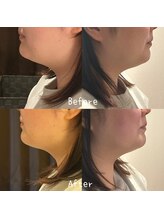 サロン ド モミカル(salon de momikaru)/レモンボトル