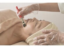 ビースキン(be-skin)/施術の様子