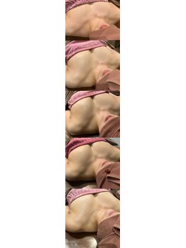 ロココ 豊田店(Rococo)/ビフォーアフター