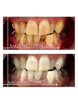 佐賀ホワイトニングラボ/