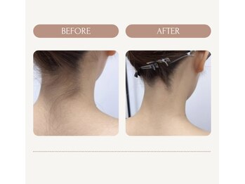 マオ(mao)/☆3回Before→after☆