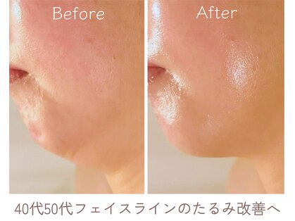 エービューティ(A.beauty)の写真