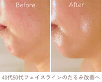 エービューティ(A.beauty)