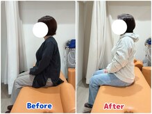 最後の整体 南郷18丁目駅院/肩こりでお悩みの方の姿勢変化