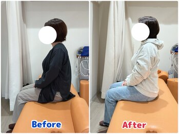 最後の整体 南郷18丁目駅院/肩こりでお悩みの方の姿勢変化