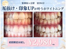 ホワイトニングショップ 多摩店