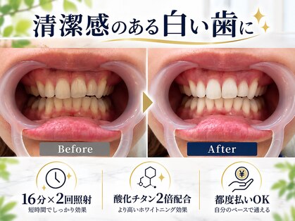 ホワイトニング ハナ 大阪本町店(Whitening Hana)の写真
