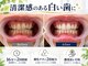 ホワイトニング ハナ 大阪本町店(Whitening Hana)の写真