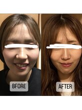 寝るジム for yuu(寝るジム フォーユー)/【ビフォーアフター】