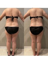 ギャラクシービューティー(galaxy beauty)/肩甲骨はがし