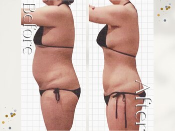 オームの森 北浜/太らない体づくり