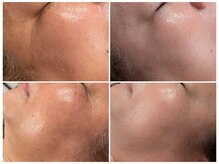 ツーアップ(2up)/目元シミ,シワ,肌質改善