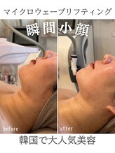 リリー(LILY)/韓国美容　LILY　