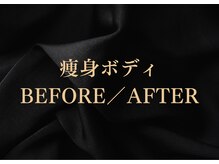 シーフェイス 横浜店(SEE FACE)/悩みに合わせて選べる痩身コース