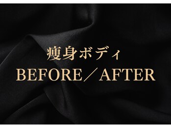 シーフェイス 横浜店(SEE FACE)/悩みに合わせて選べる痩身コース