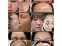 ベリッシマ(Bellissima)