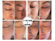 アールヨンマルハチ フェイスアンドアイ(R408.face&eye)の雰囲気（【予約殺到メニュー】シミ改善放題×肌質改善）