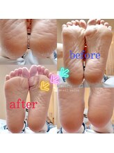 メニティ(MeniTy)/フットケア