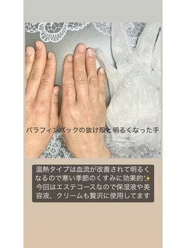 桃の木 吉祥寺店/エステは爪と違い効果が見える2