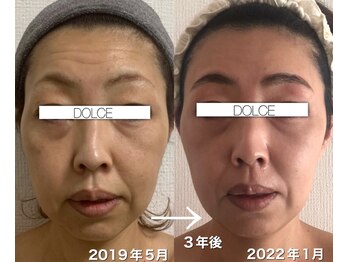 アルティ バイ ドルチェ(Ulti by dolce)/エステ×エンビロン