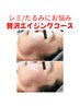 【老け顔から若見え肌へ】贅沢エイジング！シミ/たるみにお悩みの方へ◎初回