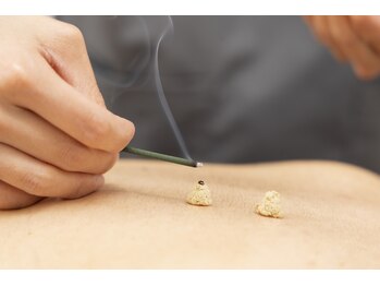 マッサージ鍼灸院つゆき按腹堂/じんわり温かいお灸