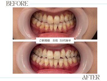 ホワイトニングサロンブライト 尼崎店(Whitening salon bright)/ホリデーシーズン