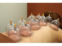 中国気功整体院 本店の雰囲気（頑固なコリには自慢の吸い玉(カッピング)でアプローチ）