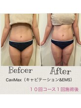 ランプ(Lampe)/全身ボデイ120分10回経過