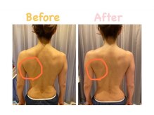 クレビア 麻布十番(CREBIA)/上半身のむくみをスッキリ！！