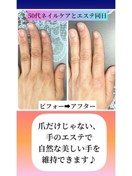 桃の木 吉祥寺店/エステは爪と違い効果が見える3