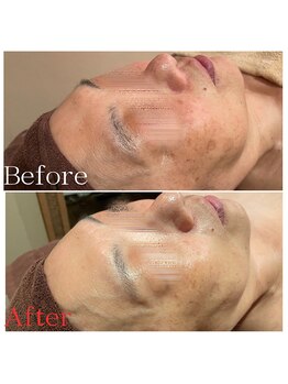 ビューティースタイリング 自由が丘店(beauty styling)/【60代からの肌質改善】