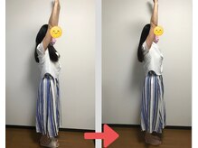 ヌフヌフ(neuf neuf)/トリートメント後のお客様の変化