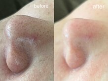 テオリア(TEORIA)/くすみもぶっ飛び魔法のエステ☆