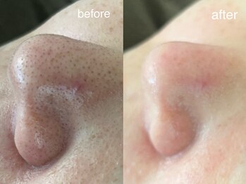 テオリア(TEORIA)/くすみもぶっ飛び魔法のエステ☆