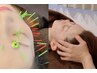 【整顔・美肌！】小顔矯正＋美顔鍼　100分￥17000→15000