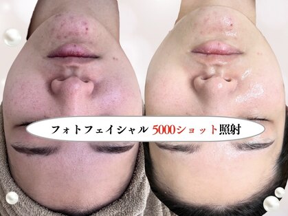 ムーム なんば店(moom)の写真