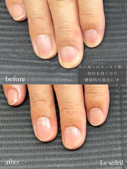 ル ソレイユ(Le soleil)/爪の角質除去で好印象に!