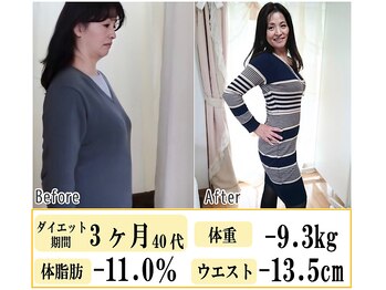 アンビジュー(un bijou)