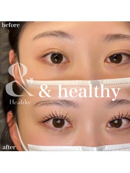 ループラス 中目黒(r'oo plus)の写真/【SNSで話題沸騰中!アンドヘルシー】で魅せる可愛いeye☆理想の抜け感とリフトアップを実現した最新技術を!