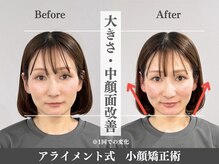 アライメント 恵比寿(Alignment)/大きさ・中顔面改善