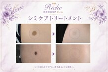 肌質改善専門Riche シミ・毛穴・たるみ【9月10日 NEWOPEN(予定)】