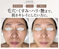 グロウ バイ フェイシャルデザイン アンド アイ(GROW)