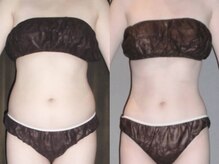 アルメリア(Armeria)/【結果写真　オーダーメイド】