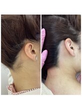エレーナ 虎ノ門(Elena)/SNSで大流行