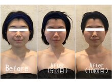 小顔フェイスラボ 一宮店(小顔 Face Labo.)の雰囲気（5回目からは無料で小顔矯正をプレゼント！骨格から小顔に改善♪）