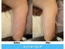 ピュアラ 心斎橋店/美白で印象UP