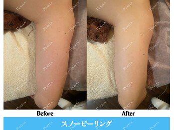 ピュアラ 心斎橋店/美白で印象UP